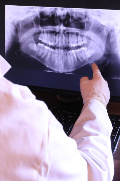 Best Knocked-Out Tooth Emergency  in El Portal, FL