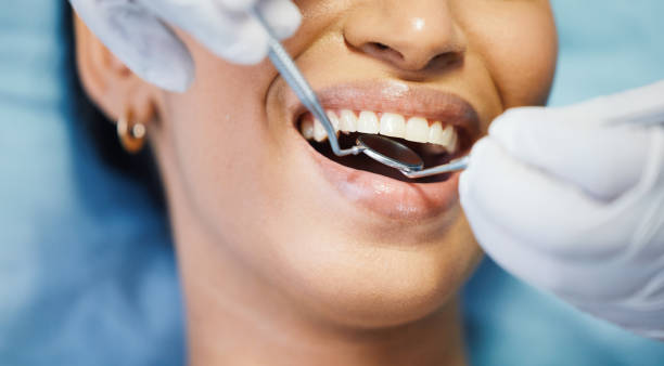 Best Urgent Tooth Repair  in El Portal, FL