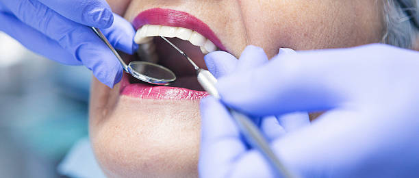 Best Tooth Infection Emergency Dentist  in El Portal, FL